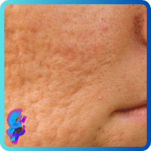 Vitalize Peel 3 139