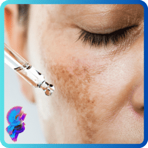 The Power of Peels 4 96